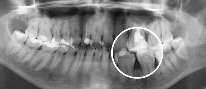 Использование искусственного интеллекта Использование искусственного интеллекта