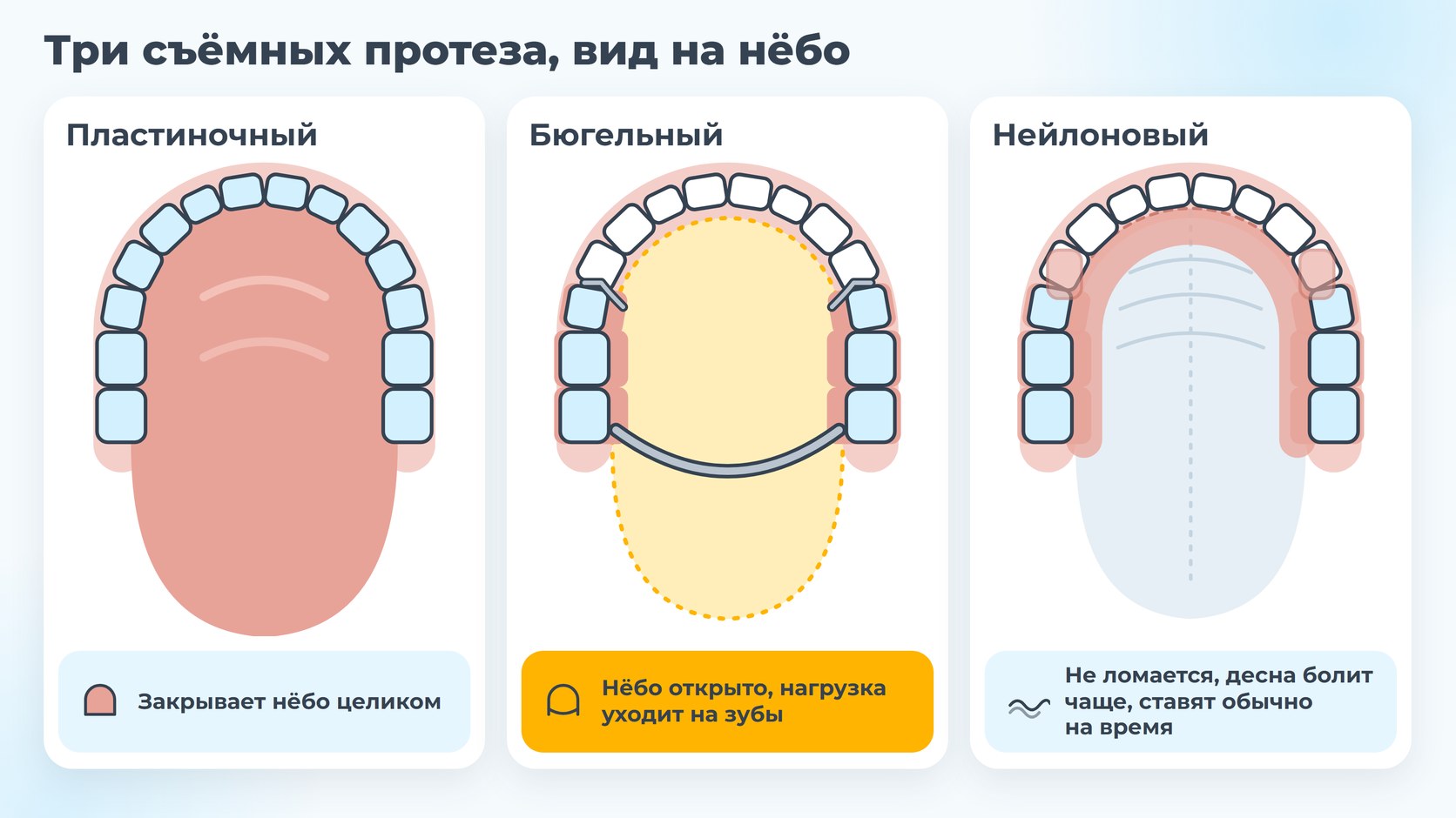 Как протезы закрывают нёбо